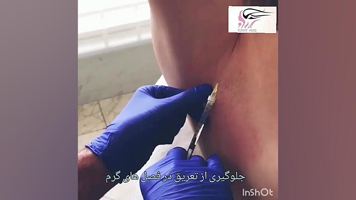 تزریق بوتاکس هشتگ خرسی