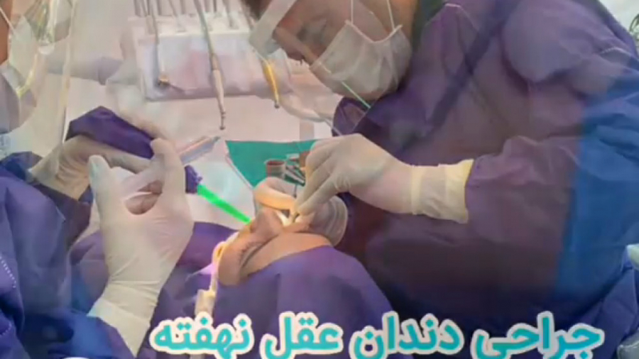 دکتر علیرضا انصار | جراحی دندان عقل نهفته ایلوبامید