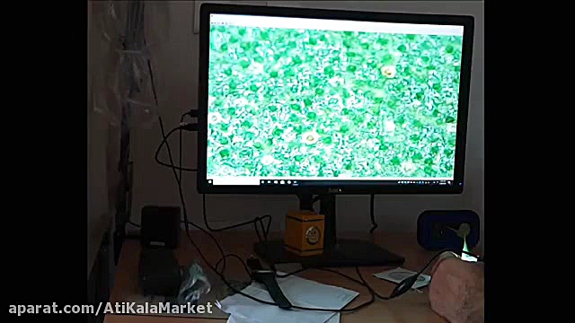 بررسی تخصصی میکروسکوپ مدل 1000X درمان سلولیت