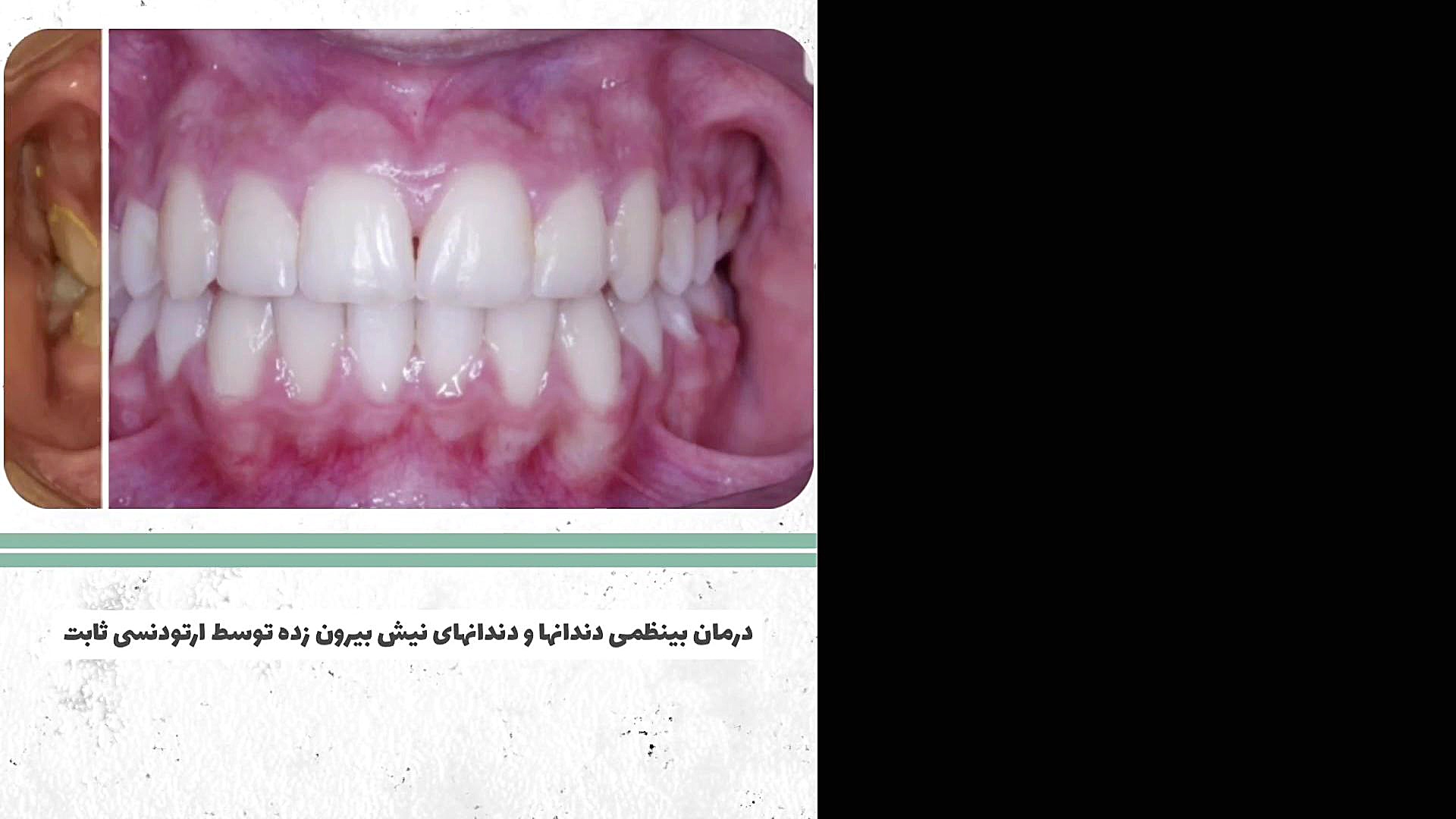 ارتودنسی دندان دکتر سعید فروغی متخصص ارتودنسی