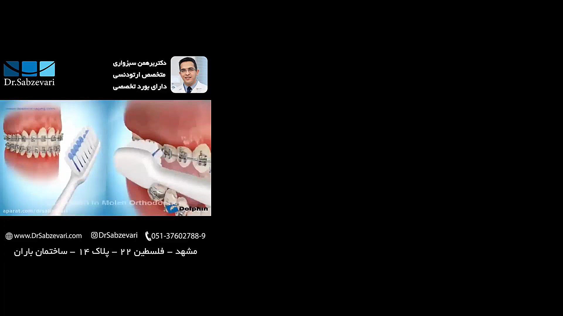 مسواک در ارتودنسی ثابت دکتر برهمن سبزواری - متخصص ارتودنسی - مشهد