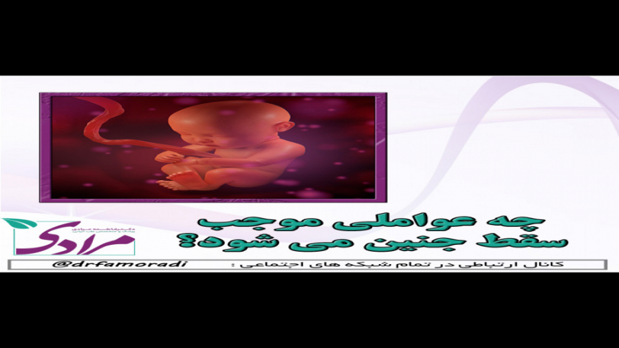 عواملی که موجب سقط جنین می شود دکتر فاطمه مرادی متخصص طب ایرانی