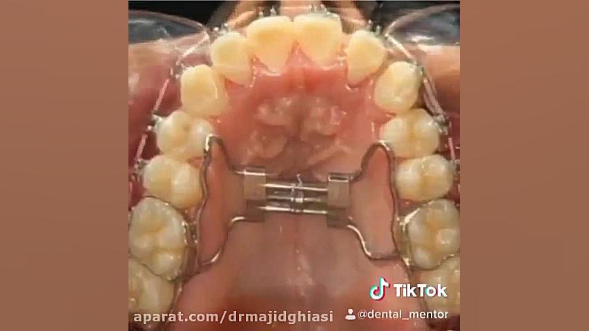 ارتودنسی دندان دکترمجیدقیاسی