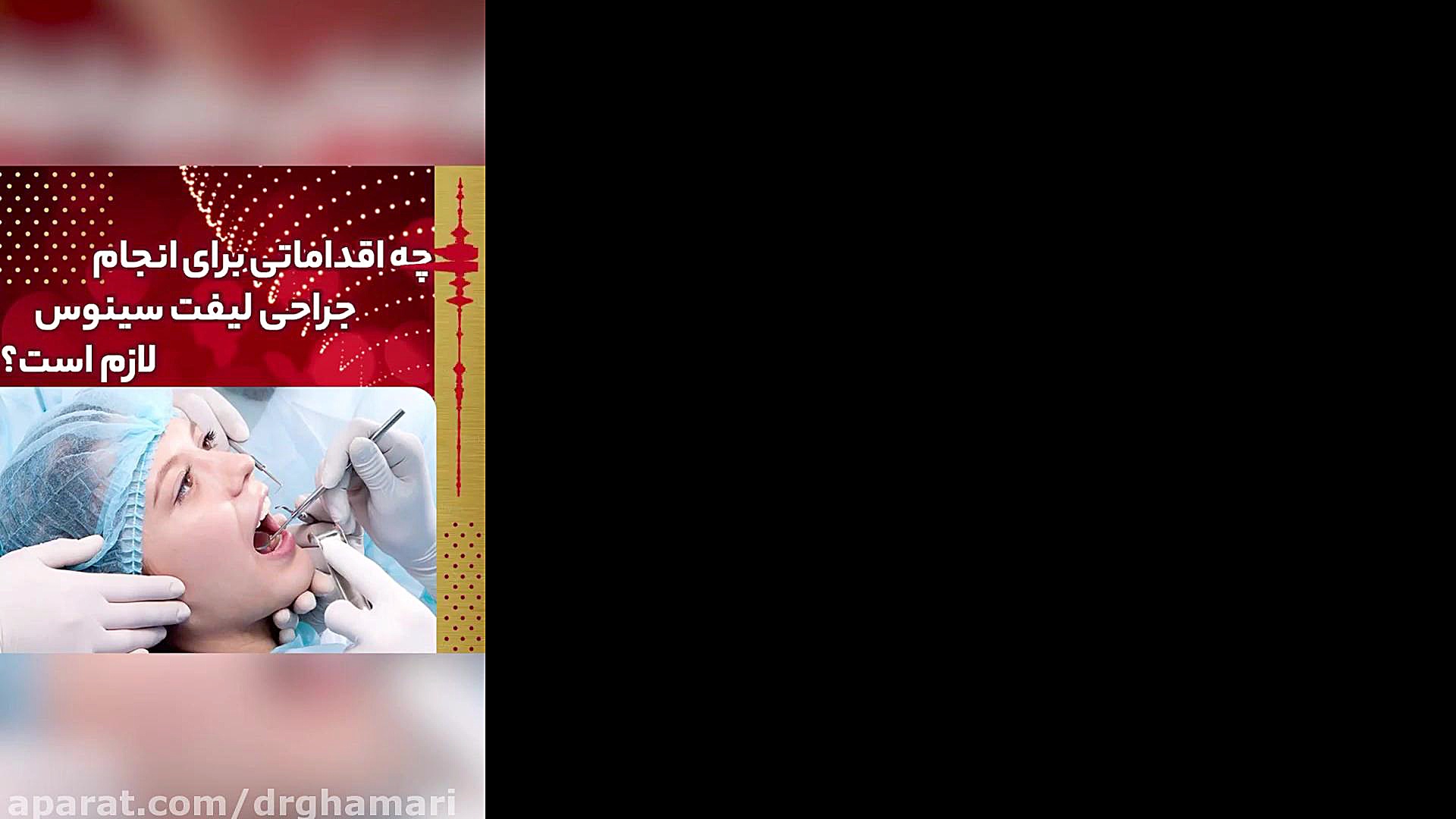 فیلم جالب در مورد جراحى ليفت سينوس دکتر علی قمری - متخصص جراحی لثه و ایمپلنت