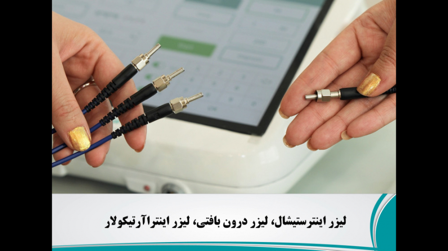 معرفی لیزر اینترستیشال (درون بافتی) ترکیبی: چند طول موج همزمان زمان131ثانیه