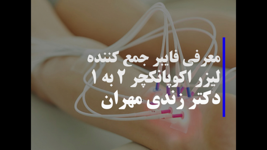 معرفی فایبر جمع کننده لیزر اکوپانکچر ۲ به ۱ (2 طول موج در یک نقطه اکوپانکچر) زمان68ثانیه