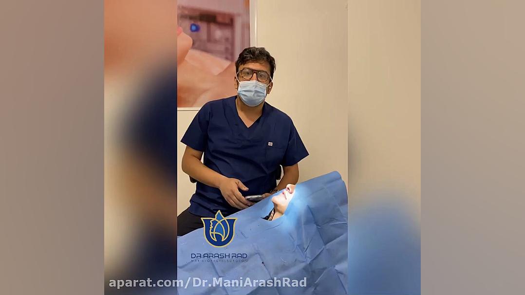 جراحی لیفت سانترال لب دکتر مانی آرش راد جراح فك و صورت