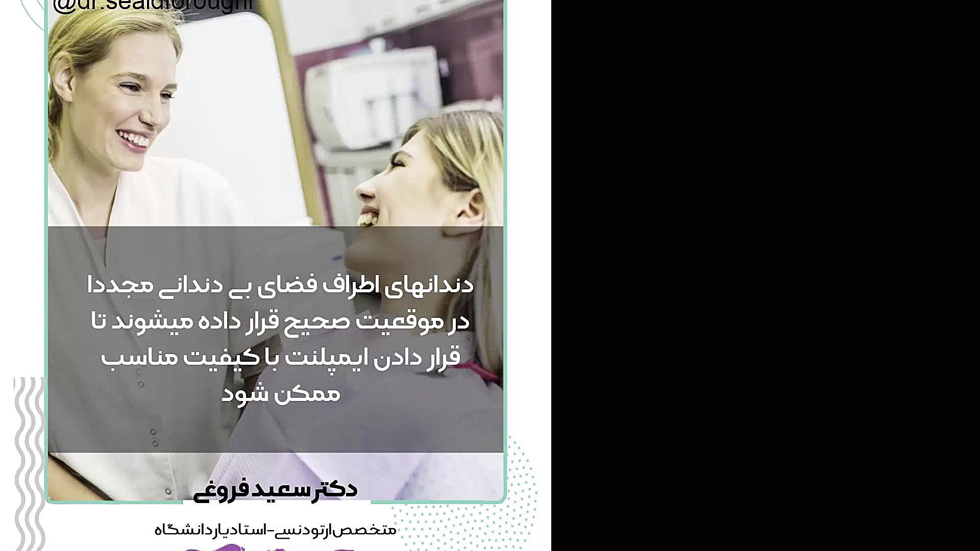 آماده کردن فضای ایمپلنت دکتر سعید فروغی متخصص ارتودنسی
