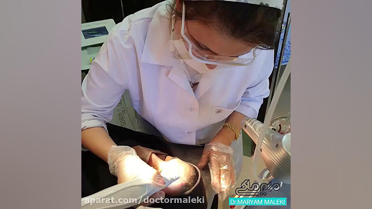 پلکسر اسکار دکتر مریم ملکی - کلینیک پوست و مو و زیبایی هور
