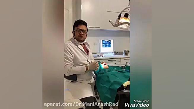 جراحی دندان نیش نهفته دکتر مانی آرش راد جراح فك و صورت