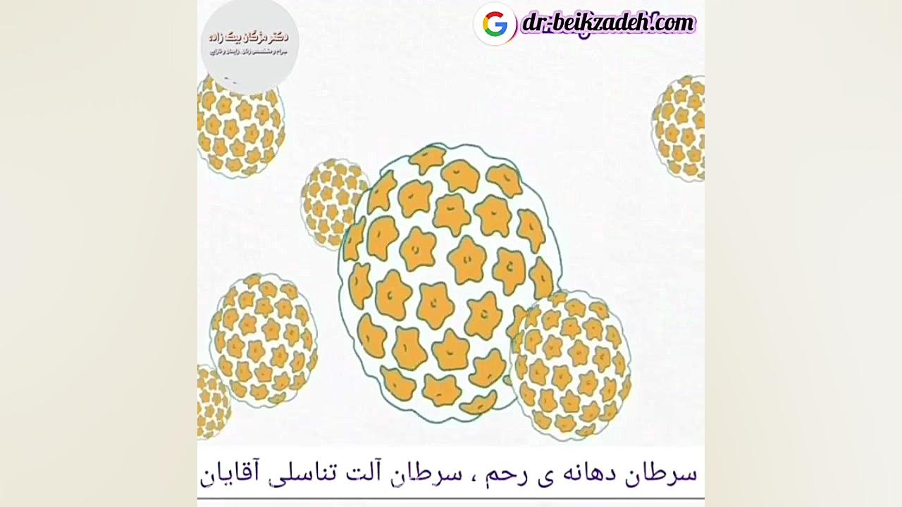 فیلم ویروس HPV و هر آنچه در مورد آن باید بدانید دکتر مژگان بیک زاده ( جراح و متخصص زنان و زایمان)