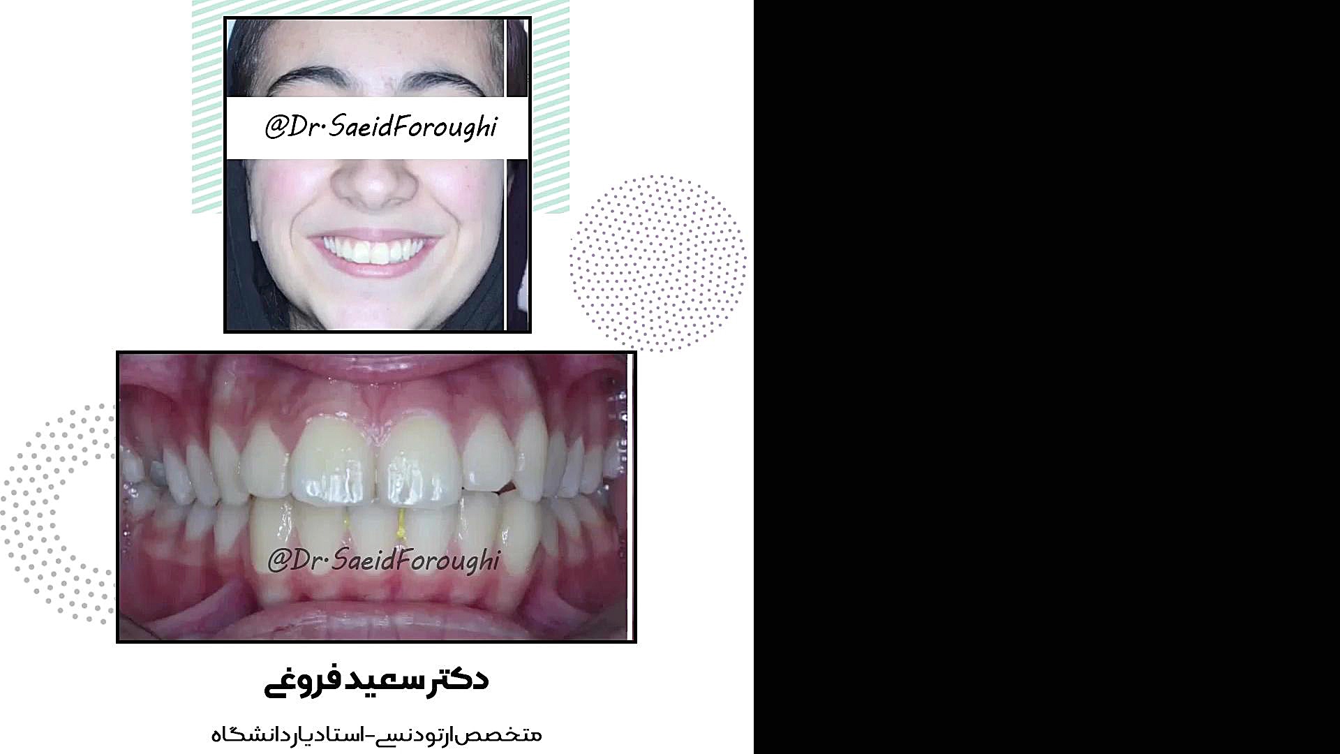 ارتودنسی دندان دکتر سعید فروغی متخصص ارتودنسی
