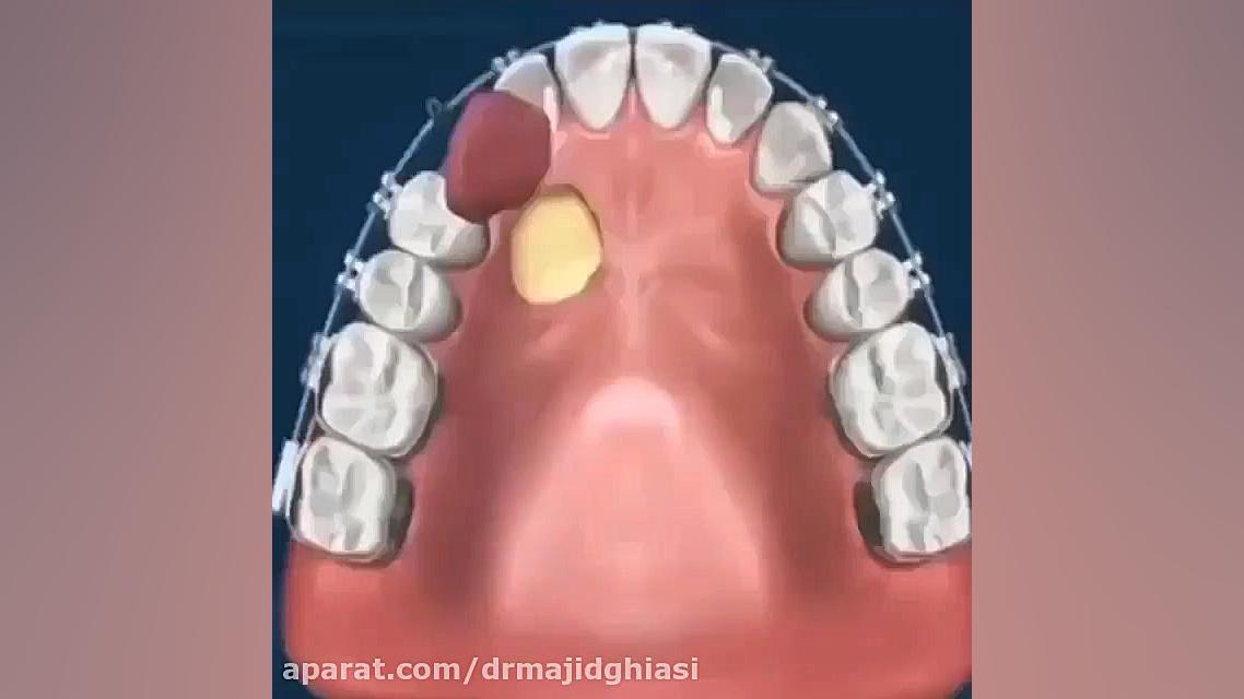 ارتودنسی دندان دکترمجیدقیاسی