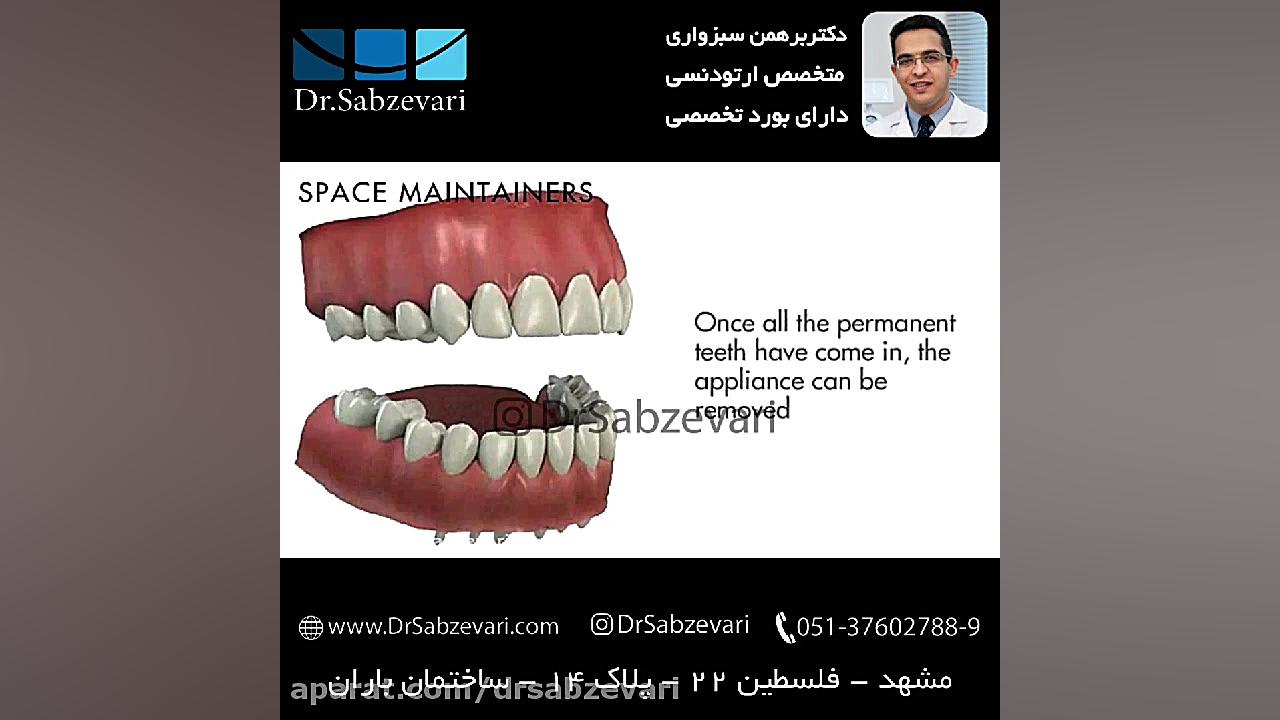 فضانگهدار دوره دندانی مختلط - 2 دکتر برهمن سبزواری - متخصص ارتودنسی - مشهد