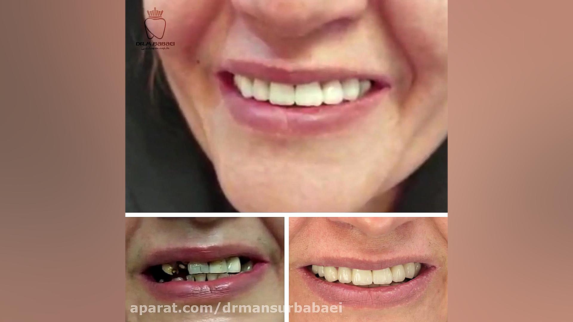 نمونه کار دکتر منصور بابایی دکتر منصور بابایی