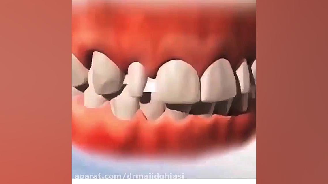 ارتودنسی دندان زیبایی دکترمجیدقیاسی