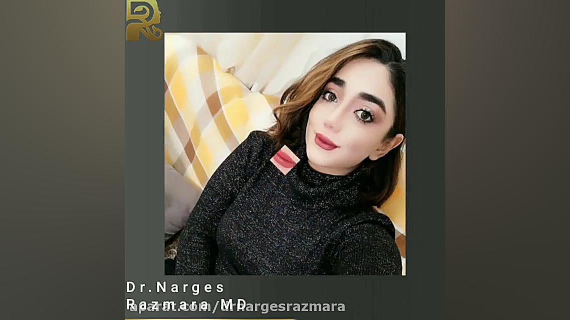 عمل بینی طبیعی دو سال بعد از عمل کاشت ریش