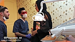 کشیدن دندون خانم با ابزار لوله...