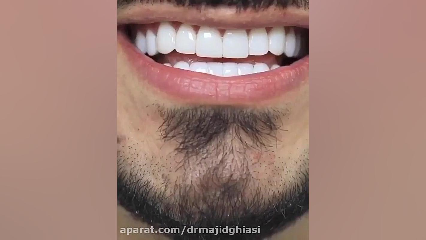 زیبایی دندان ؛لبخند زیبا هدیه ما به شما دکترمجیدقیاسی