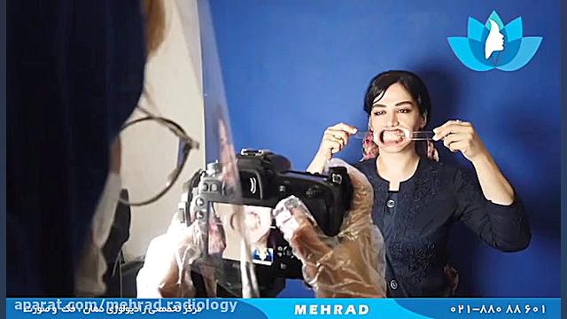 رادیولوژی مهراد پاکسازی پوست