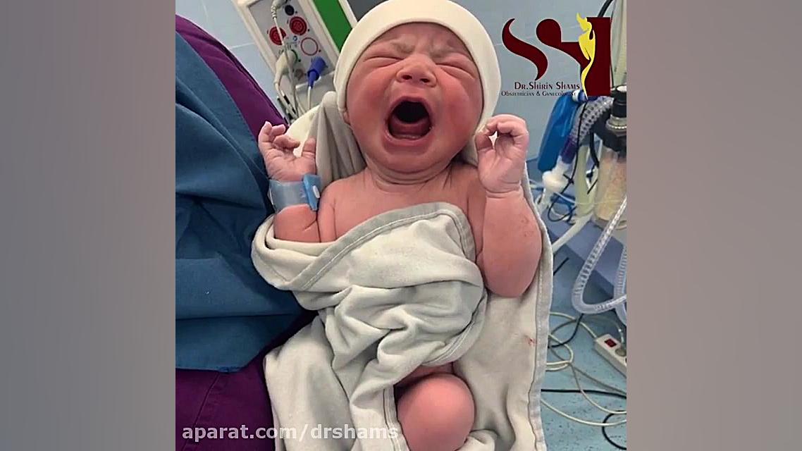 فیلم عمل سزارین به همراه جراحی مینی ابدومینوپلاستی دکتر شیرین شمس جراح و متخصص زنان و زایمان