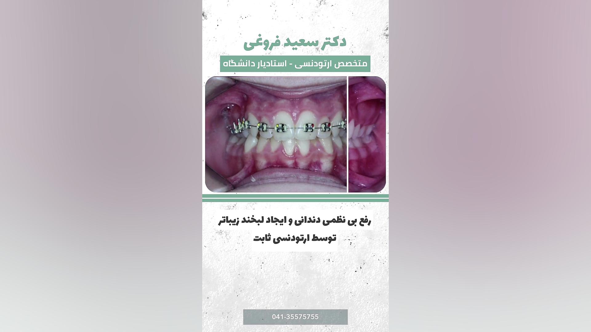 قوس دندان دکتر سعید فروغی متخصص ارتودنسی