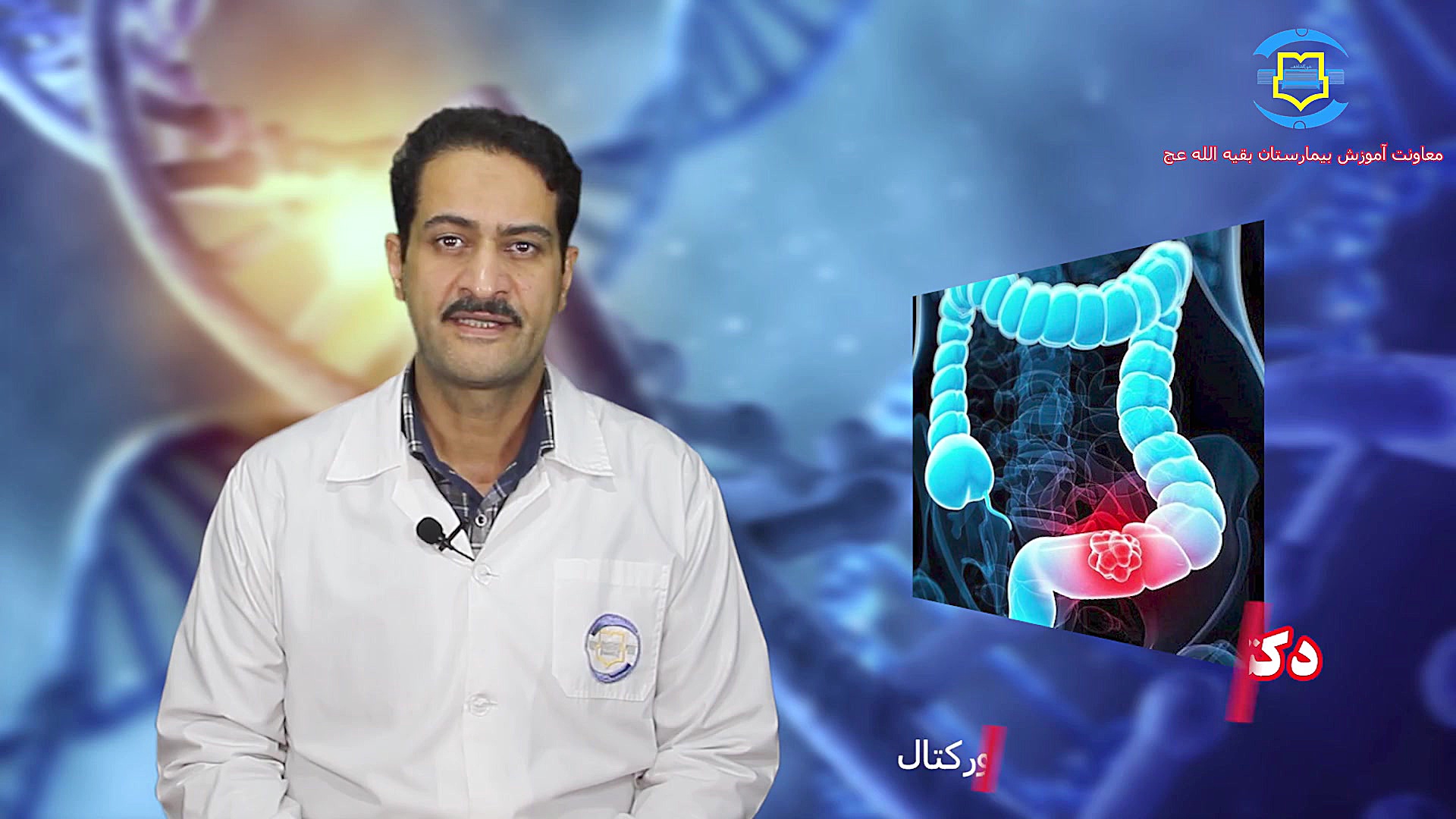 علایم و درمان سرطان روده بزرک و رکتوم (کولورکتال) - دکتر شهرام منوچهری لیپوساکشن
