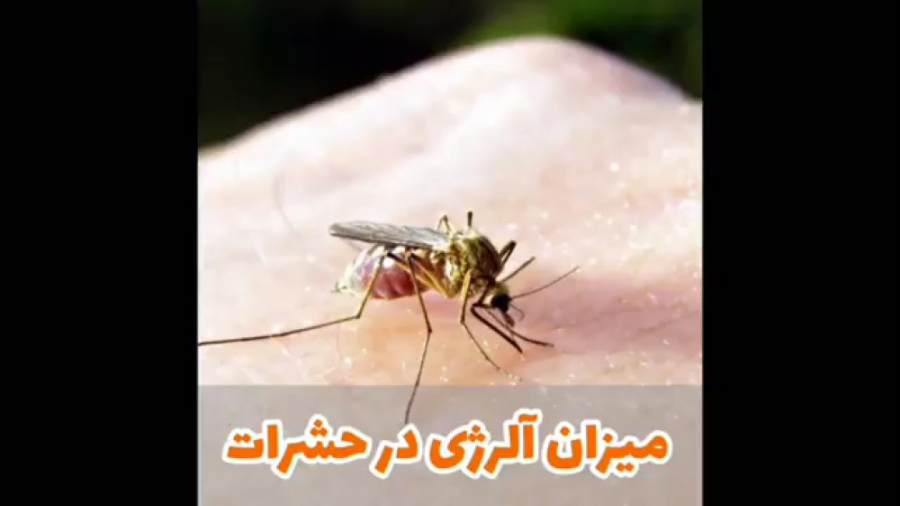 فیلم واقعی از آلرژی به حشرات دکتر یعقوب محبوبی اسکوئی