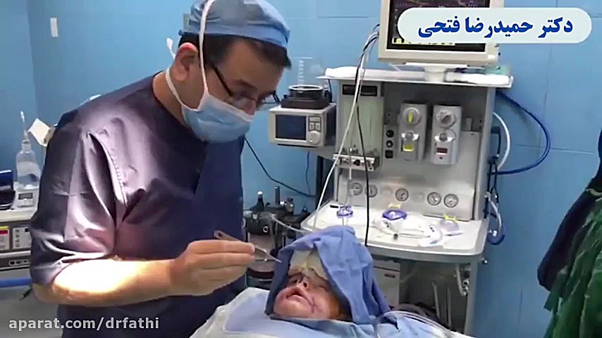 جراحی شکاف لب و کام دکتر حمید رضا فتحی فوق تخصص جراحی پلاستیک