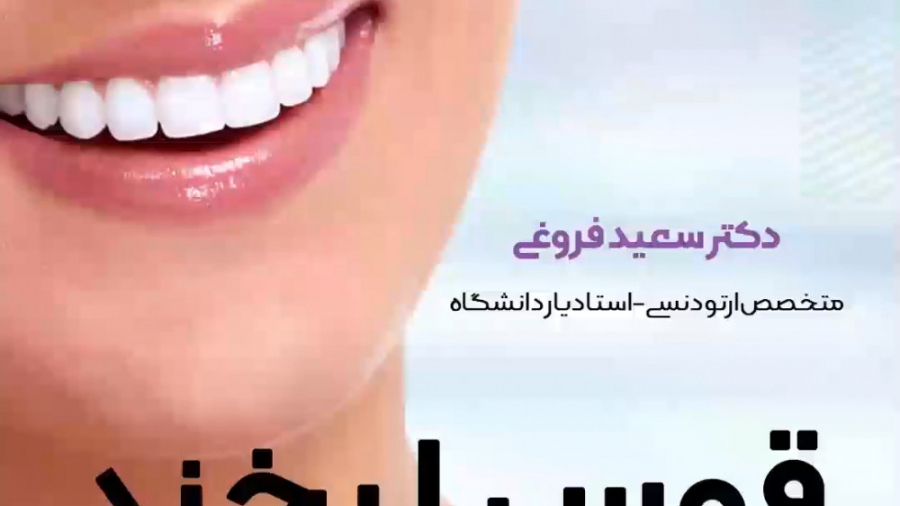 قوس دندان دکتر سعید فروغی متخصص ارتودنسی