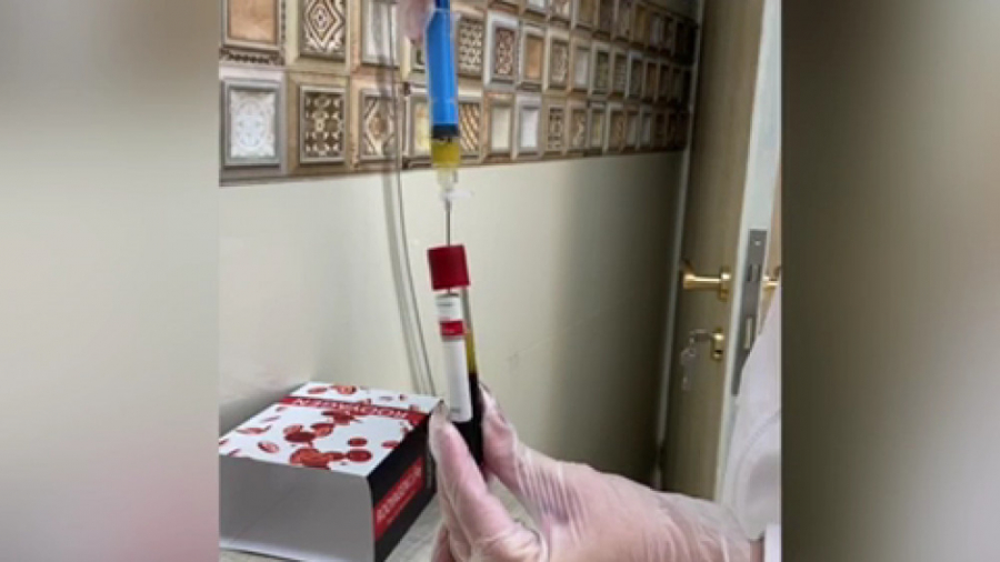 تزریق PRP برای رشد وتقویت موهای سر دکتر فرحناز زینعلی - متخصص پوست، مو، زیبایی زنجان