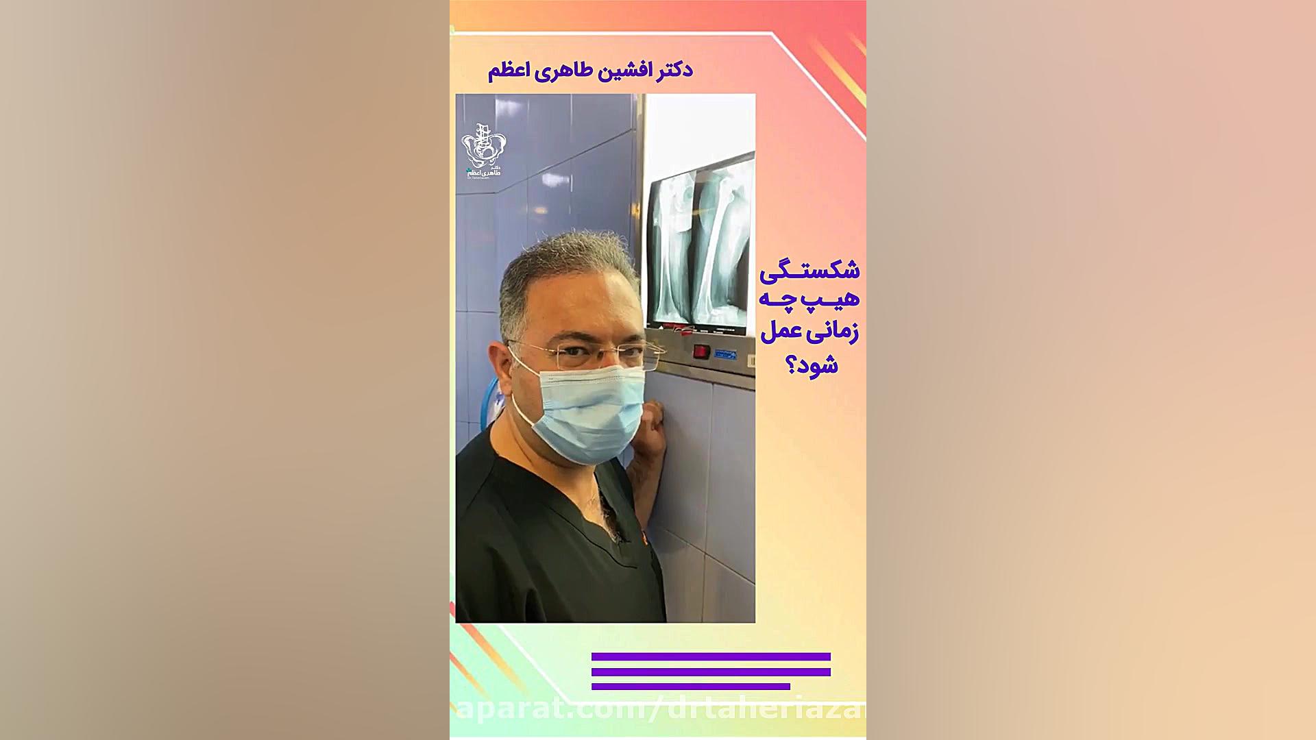 شکستگی هیپ چه زمانی باید جراحی شود؟ یوتیوب