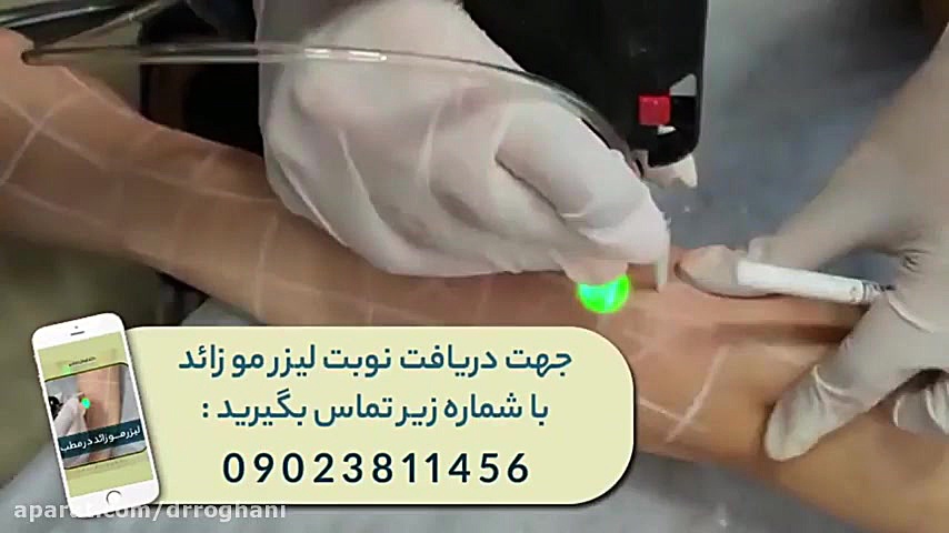 تمام آنچه که باید از لیزر مو زائد با دستگاه الکس دکتر ایمان روغنی جراح و متخصص پوست و مو