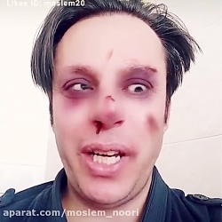 تزریق اولین واکسن کرونا در ایر...