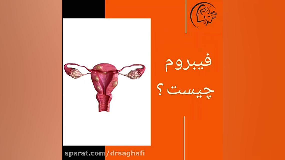 فیلم فیبروم رحمی و میوم جراحی فک