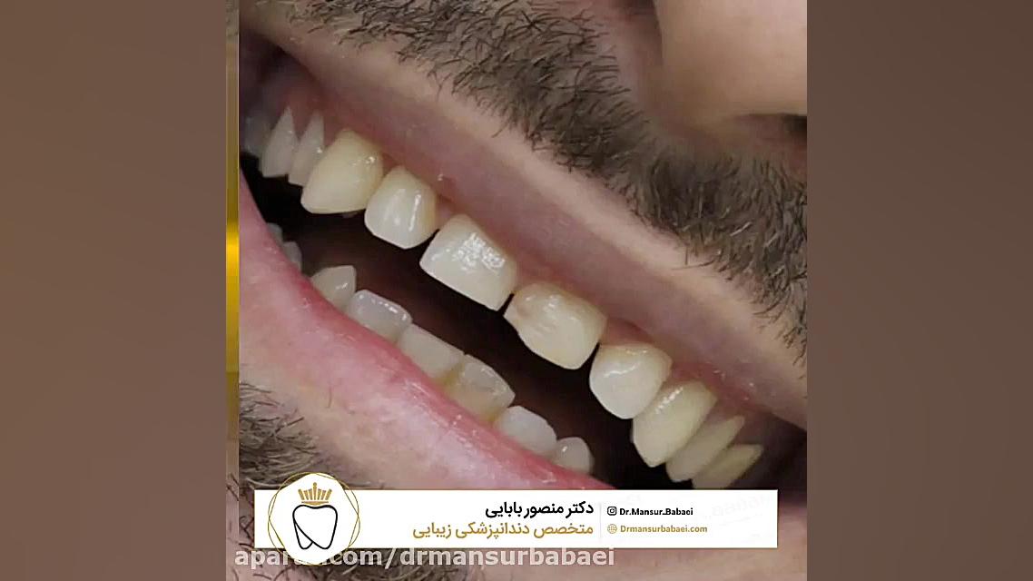 به راحتی اعتماد به نفستان را افزایش دهید دکتر منصور بابایی