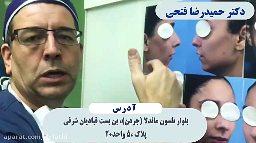 فیلم واقعی عمل بینی بلافاصله پس از جراحی دکتر حمید رضا فتحی فوق تخصص جراحی پلاستیک