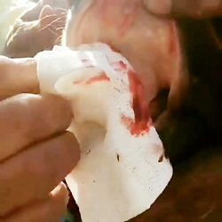 شکستن فک اسب