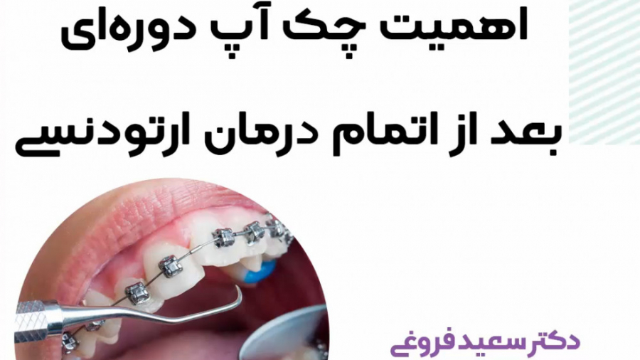 اهمیت چکاپ دوره ای بعد از اتمام ارتودنسی دکتر سعید فروغی متخصص ارتودنسی
