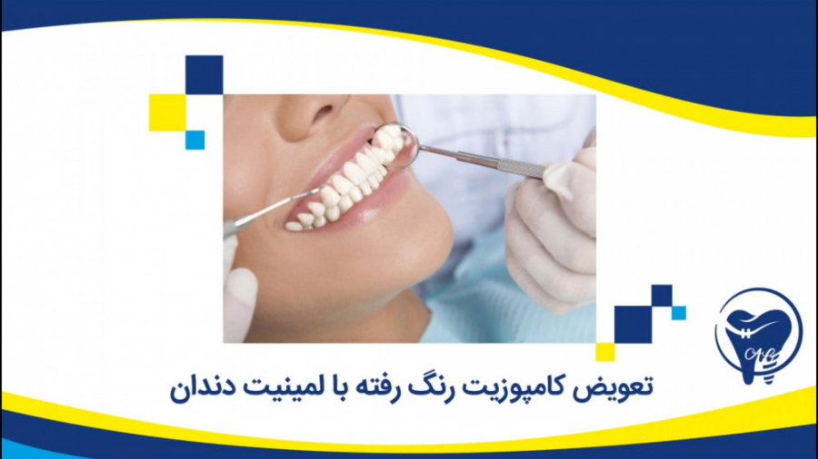 تعویض کامپوزیت رنگ رفته با لمینت دندان کلینیک دندانپزشکی دکتر عزیز گشاده رو