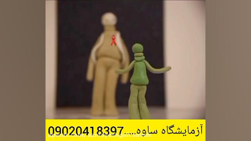 اچ آی وی - ایدز قسمت 2 - ازمایشگاه ساوه.....09020418397 عصب‌کشی