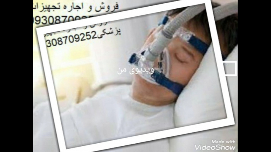 اجاره سی پپ ، بای پپ ؛ اکسیژن ساز ؛ ونتیلاتور اینسایزینگ