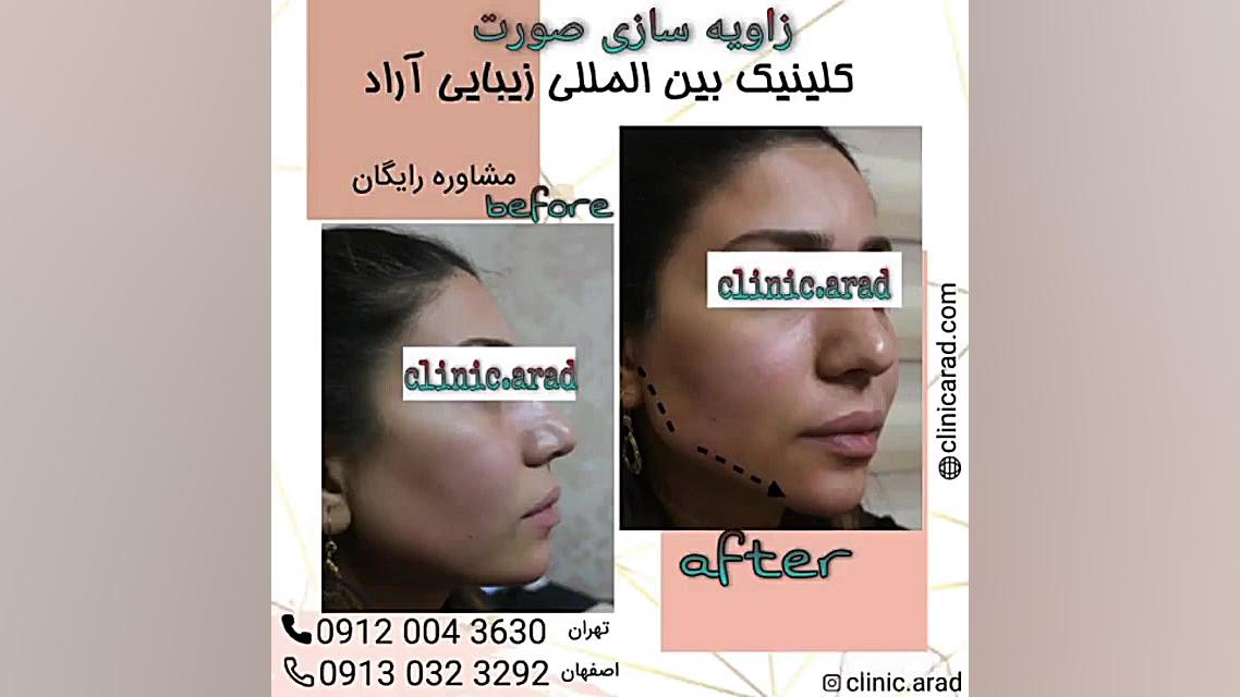 زاویه سازی صورت پزشکی ویرایش ژن