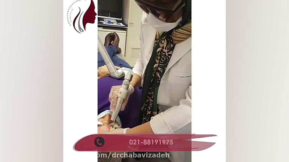 فیلم واقعی پاک کردن تاتو با لیزر دکتر صفیه چعباوی زاده