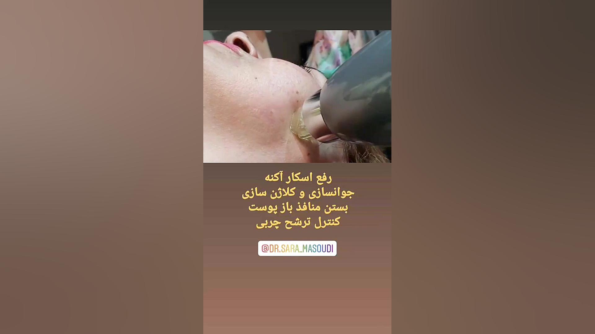 آر اف فرکشنال کاشان پروتز دندان
