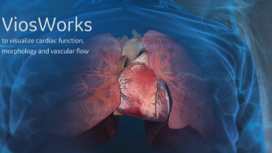 ViosWorks تصویربرداری MRI هفت بعدی از قلب کیهان کلهر
