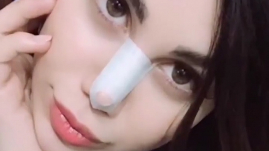 نمونه کار جراحی بینی دکتر علی باقری حق