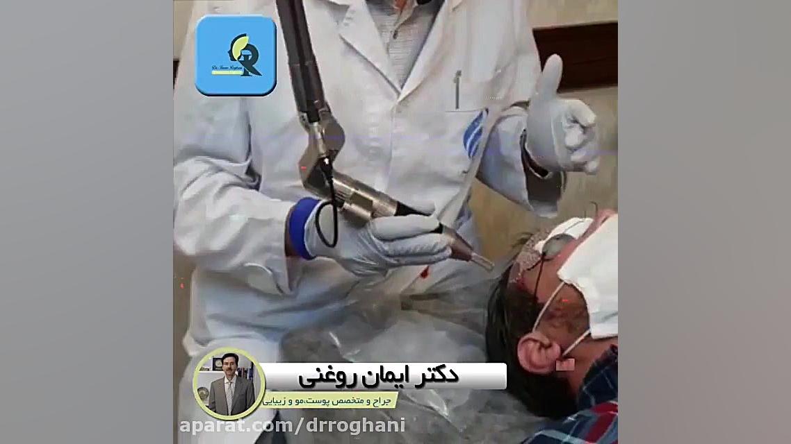 کاربرد لیزر کیوسوئیچ دکتر ایمان روغنی جراح و متخصص پوست و مو