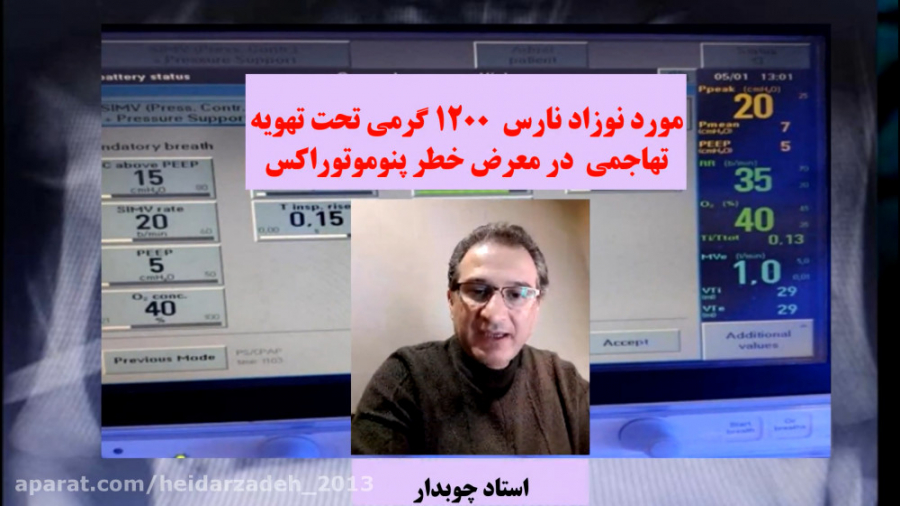 مورد نوزاد نارس 1200 گرمی تحت تهویه تهاجمی در معرض خطر پنوموتوراکس شکیرا