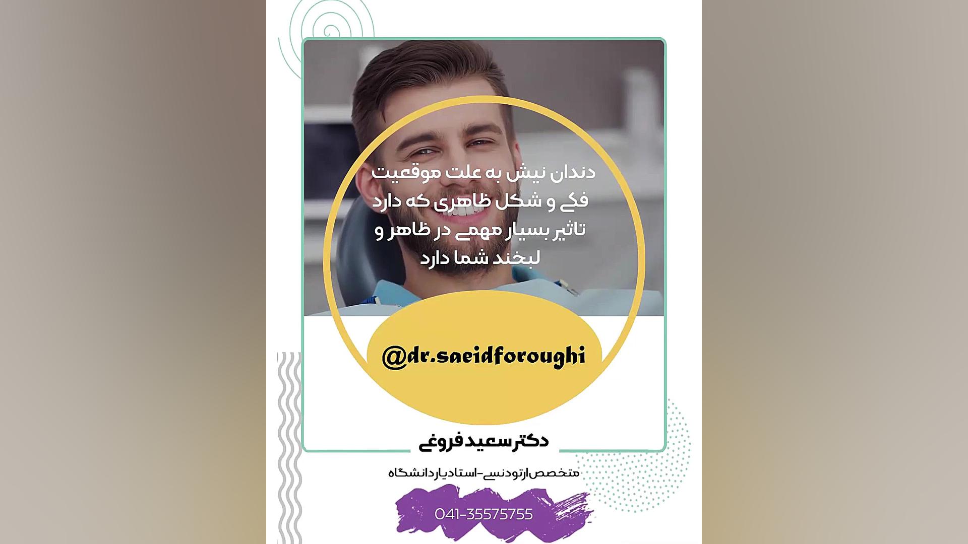 دندانهای نیش بیرون زده دکتر سعید فروغی متخصص ارتودنسی
